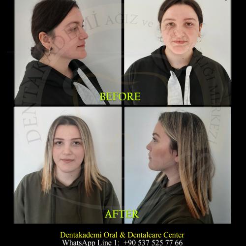 Пластическая и эстетическая хирургия Фото до / после